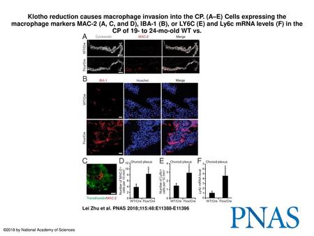 Klotho reduction causes macrophage invasion into the CP