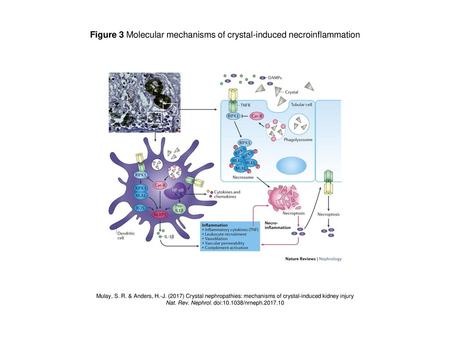 Figure 3 Molecular mechanisms of crystal-induced necroinflammation