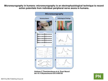 Microneurography in humans: microneurography is an electrophysiological technique to record action potentials from individual peripheral nerve axons in.