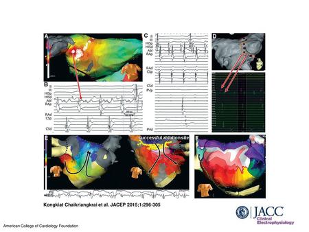 Kongkiat Chaikriangkrai et al. JACEP 2015;1: