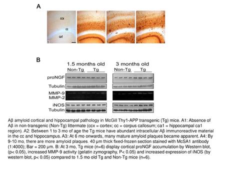 Aβ amyloid cortical and hippocampal pathology in McGill Thy1-APP transgenic (Tg) mice. A1: Absence of Aβ in non-transgenic (Non-Tg) littermate (ccx = cortex;