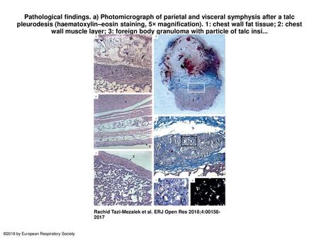 Pathological findings