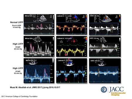 Muaz M. Abudiab et al. JIMG 2017;j.jcmg