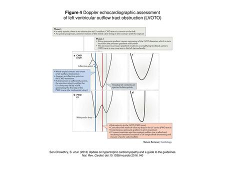 Figure 4 Doppler echocardiographic assessment