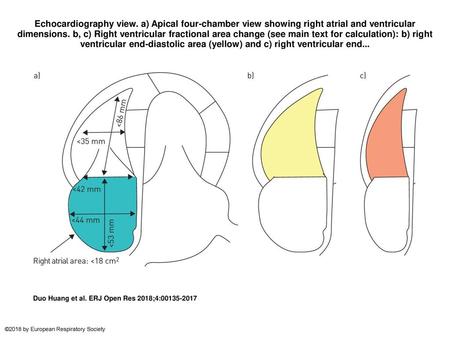 Echocardiography view