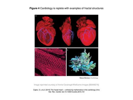 Figure 4 Cardiology is replete with examples of fractal structures