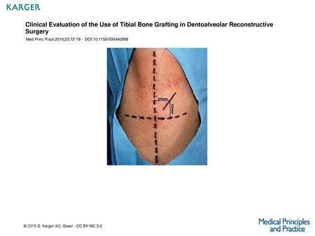 Med Princ Pract 2016;25: DOI: /