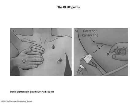 The BLUE points. The BLUE points. The BLUE points respect LUCI principles 3 and 7. They have been made simple for expediting protocols without loss of.