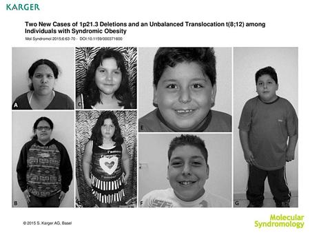 Two New Cases of 1p21.3 Deletions and an Unbalanced Translocation t(8;12) among Individuals with Syndromic Obesity Mol Syndromol 2015;6:63-70 - DOI:10.1159/000371600.