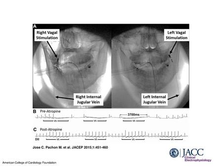 Jose C. Pachon M. et al. JACEP 2015;1: