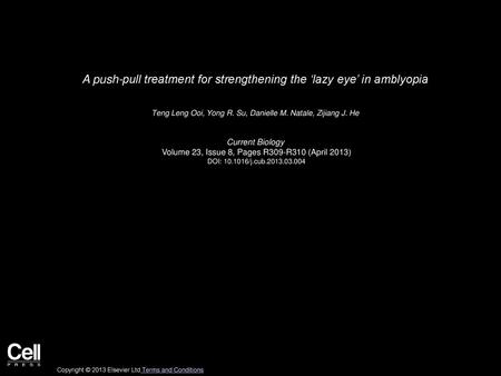 A push-pull treatment for strengthening the ‘lazy eye’ in amblyopia