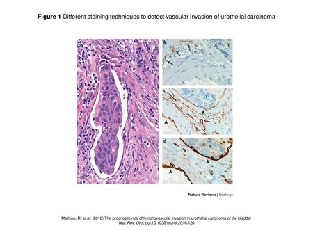 Nat. Rev. Urol. doi: /nrurol