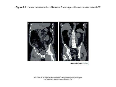 Nat. Rev. Urol. doi: /nrurol