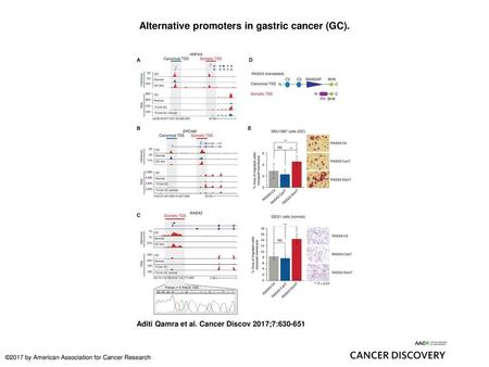 Alternative promoters in gastric cancer (GC).