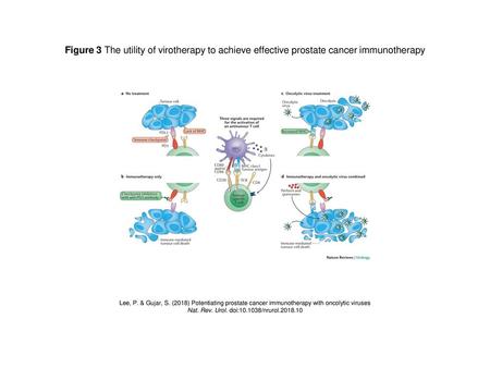 Nat. Rev. Urol. doi: /nrurol