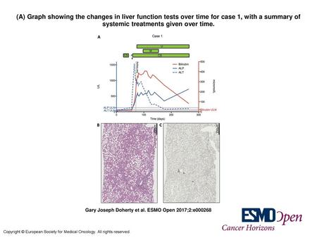 (A) Graph showing the changes in liver function tests over time for case 1, with a summary of systemic treatments given over time. (A) Graph showing the.