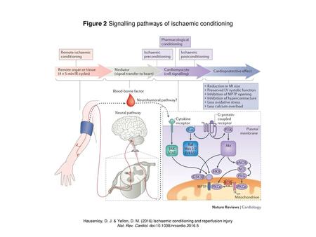 Figure 2 Signalling pathways of ischaemic conditioning