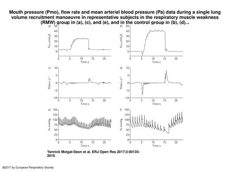 Mouth pressure (Pmo), flow rate and mean arterial blood pressure (Pa) data during a single lung volume recruitment manoeuvre in representative subjects.