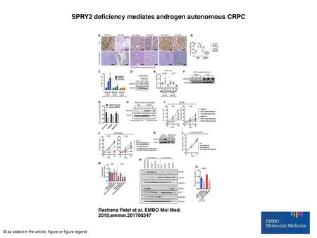 SPRY2 deficiency mediates androgen autonomous CRPC