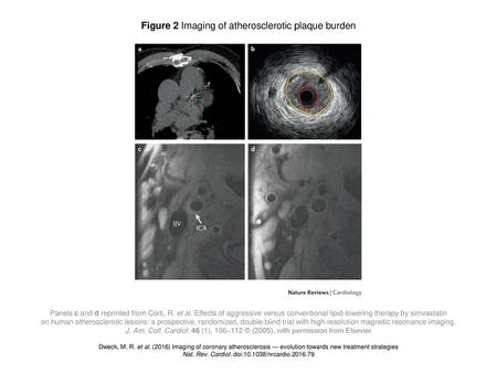 Figure 2 Imaging of atherosclerotic plaque burden