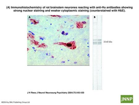 (A) Immunohistochemistry of rat brainstem neurones reacting with anti-Hu antibodies showing strong nuclear staining and weaker cytoplasmic staining (counterstained.