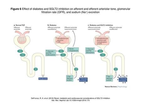 filtration rate (GFR), and sodium (Na+) excretion