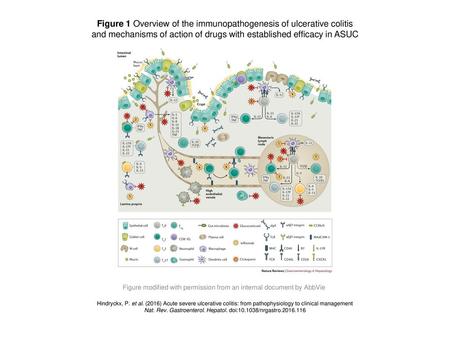 Figure 1 Overview of the immunopathogenesis of ulcerative colitis