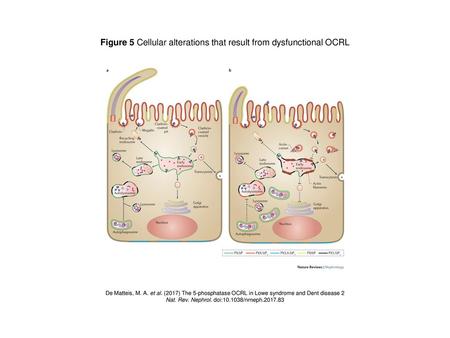 Figure 5 Cellular alterations that result from dysfunctional OCRL