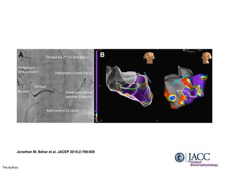 Jonathan M. Behar et al. JACEP 2016;2: