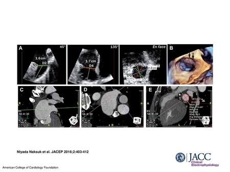 Niyada Naksuk et al. JACEP 2016;2: