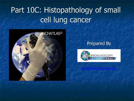 Part 10C: Histopathology of small cell lung cancer