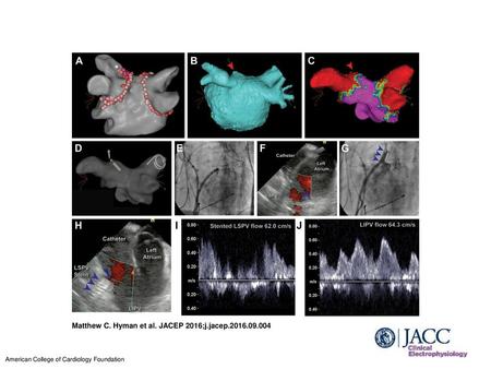 Matthew C. Hyman et al. JACEP 2016;j.jacep