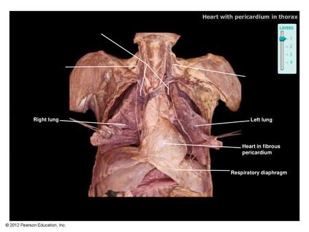 Right lung Left lung Heart in fibrous pericardium 01_A3485_labeled.jpg