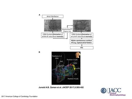 Junaid A.B. Zaman et al. JACEP 2017;3: