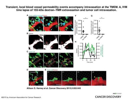 Transient, local blood vessel permeability events accompany intravasation at the TMEM. A, IVM time lapse of 155-kDa dextran–TMR extravasation and tumor.