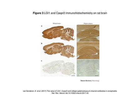 Figure 3 LGI1 and Caspr2 immunohistochemistry on rat brain