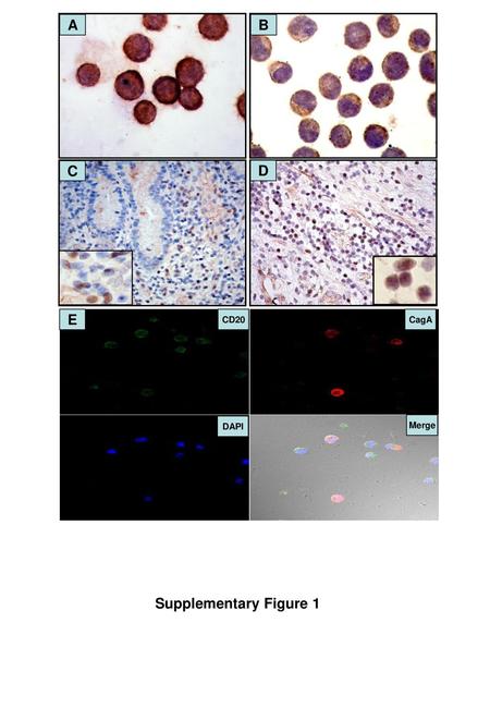 A B C D E CD20 CagA DAPI Merge Supplementary Figure 1.