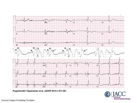 Pugazhendhi Vijayaraman et al. JACEP 2015;1: