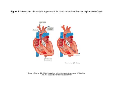 Nat. Rev. Cardiol. doi: /nrcardio