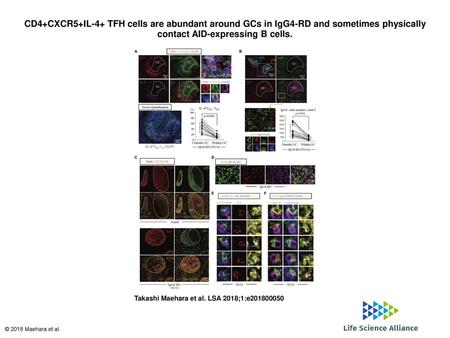 CD4+CXCR5+IL-4+ TFH cells are abundant around GCs in IgG4-RD and sometimes physically contact AID-expressing B cells. CD4+CXCR5+IL-4+ TFH cells are abundant.