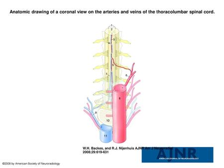 Anatomic drawing of a coronal view on the arteries and veins of the thoracolumbar spinal cord. Anatomic drawing of a coronal view on the arteries and veins.