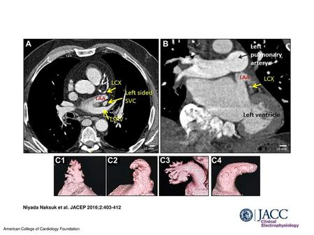 Niyada Naksuk et al. JACEP 2016;2: