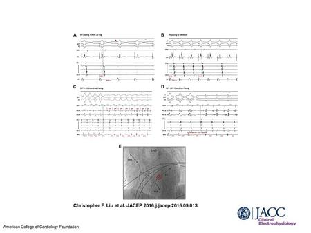 Christopher F. Liu et al. JACEP 2016;j.jacep