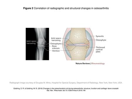 Nat. Rev. Rheumatol. doi: /nrrheum