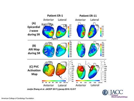 Junjie Zhang et al. JACEP 2017;j.jacep