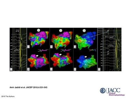 Amir Jadidi et al. JACEP 2018;4: