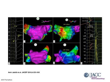 Amir Jadidi et al. JACEP 2018;4: