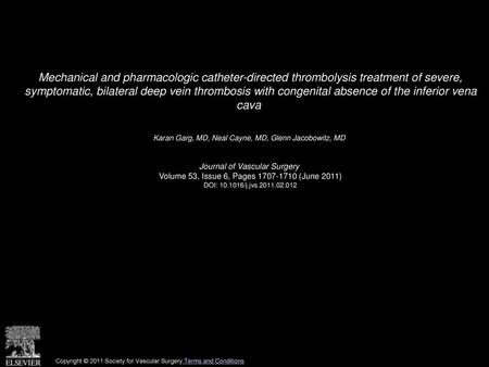 Mechanical and pharmacologic catheter-directed thrombolysis treatment of severe, symptomatic, bilateral deep vein thrombosis with congenital absence of.