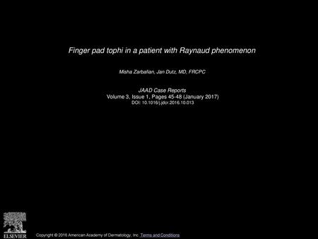 Finger pad tophi in a patient with Raynaud phenomenon