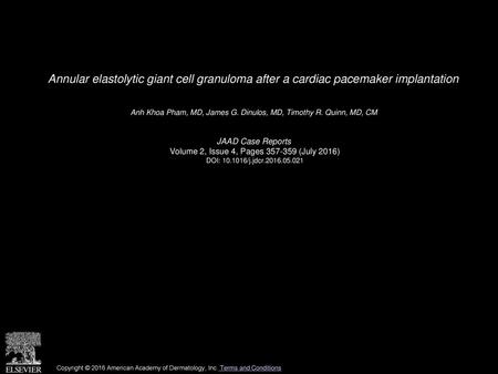 Anh Khoa Pham, MD, James G. Dinulos, MD, Timothy R. Quinn, MD, CM 